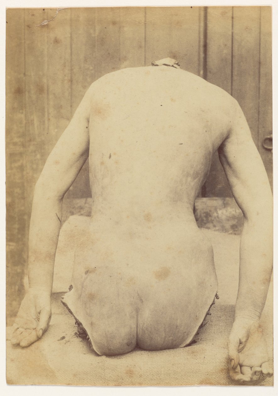  av Alphonse Bertillon