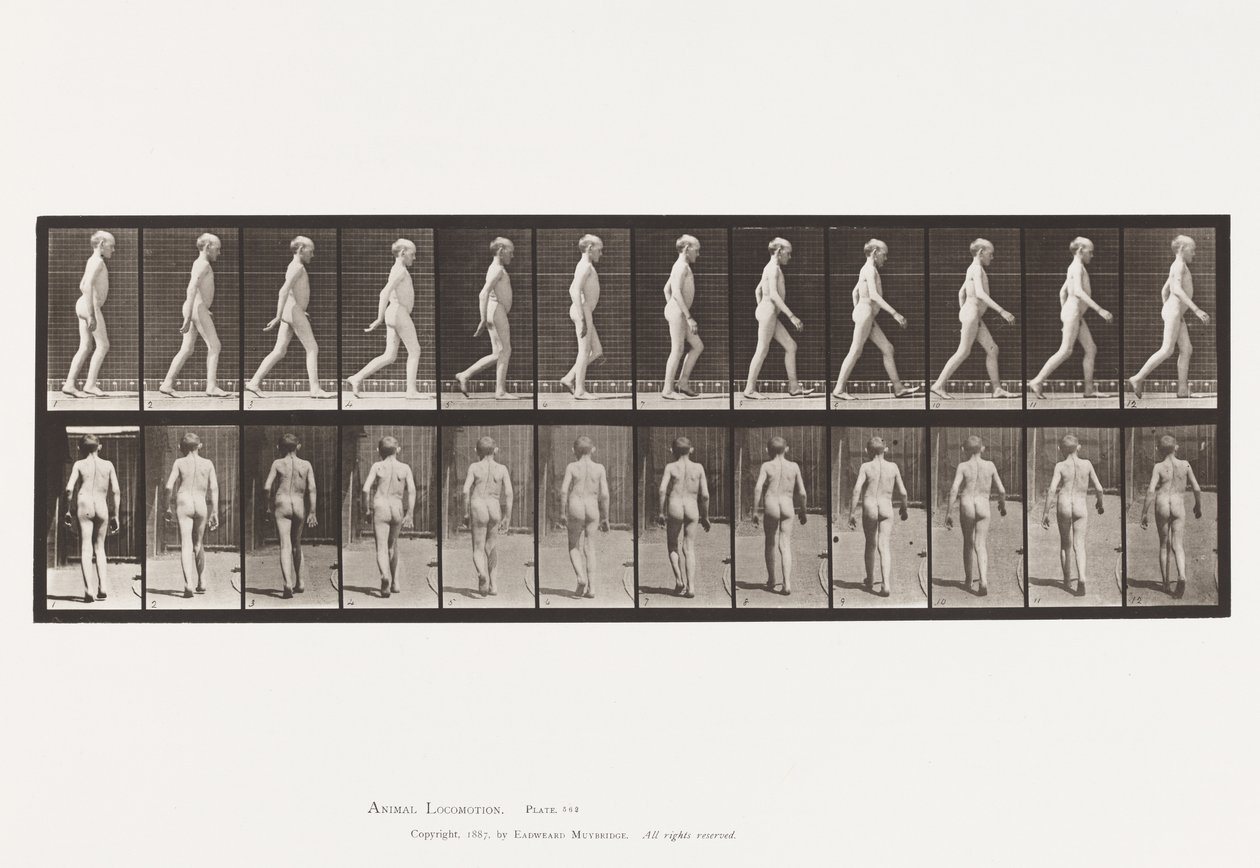 Plate 562. Lateral Curvature of Spine; Går av Eadweard Muybridge