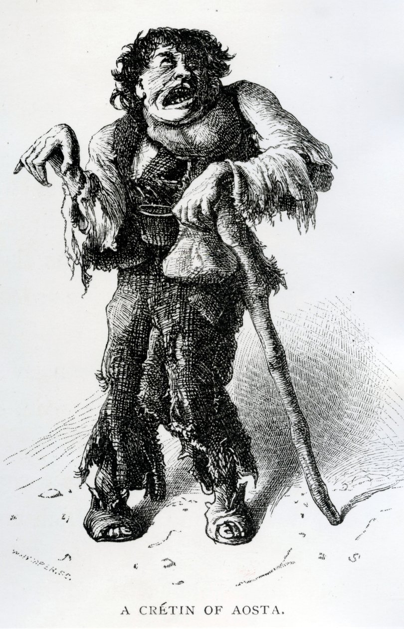 A Crétin of Aosta, ca. 1870 (tregravering) av Edward Whymper