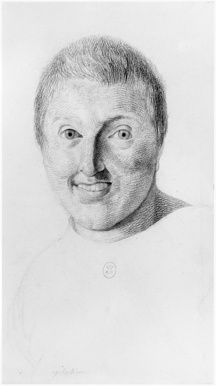 Epileptisk kvinne, sett forfra, illustrasjon fra en upublisert avhandling av Jean Etienne Dominique Esquirol (1772-1840) om galningene på Salpetriere-asylet, ca. 1818 av Georges Francois Gabriel