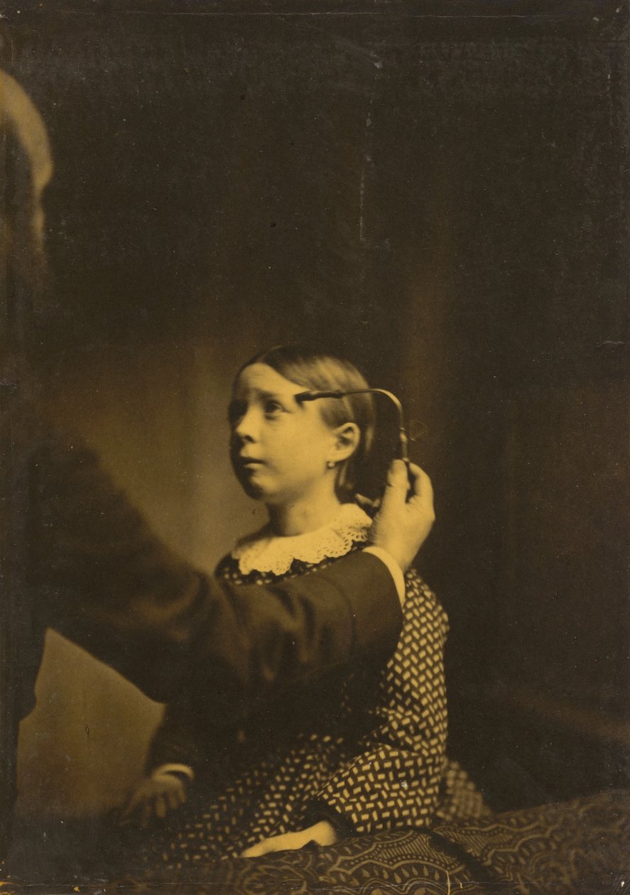 Smertefulle minner av Guillaume Benjamin Amant Duchenne