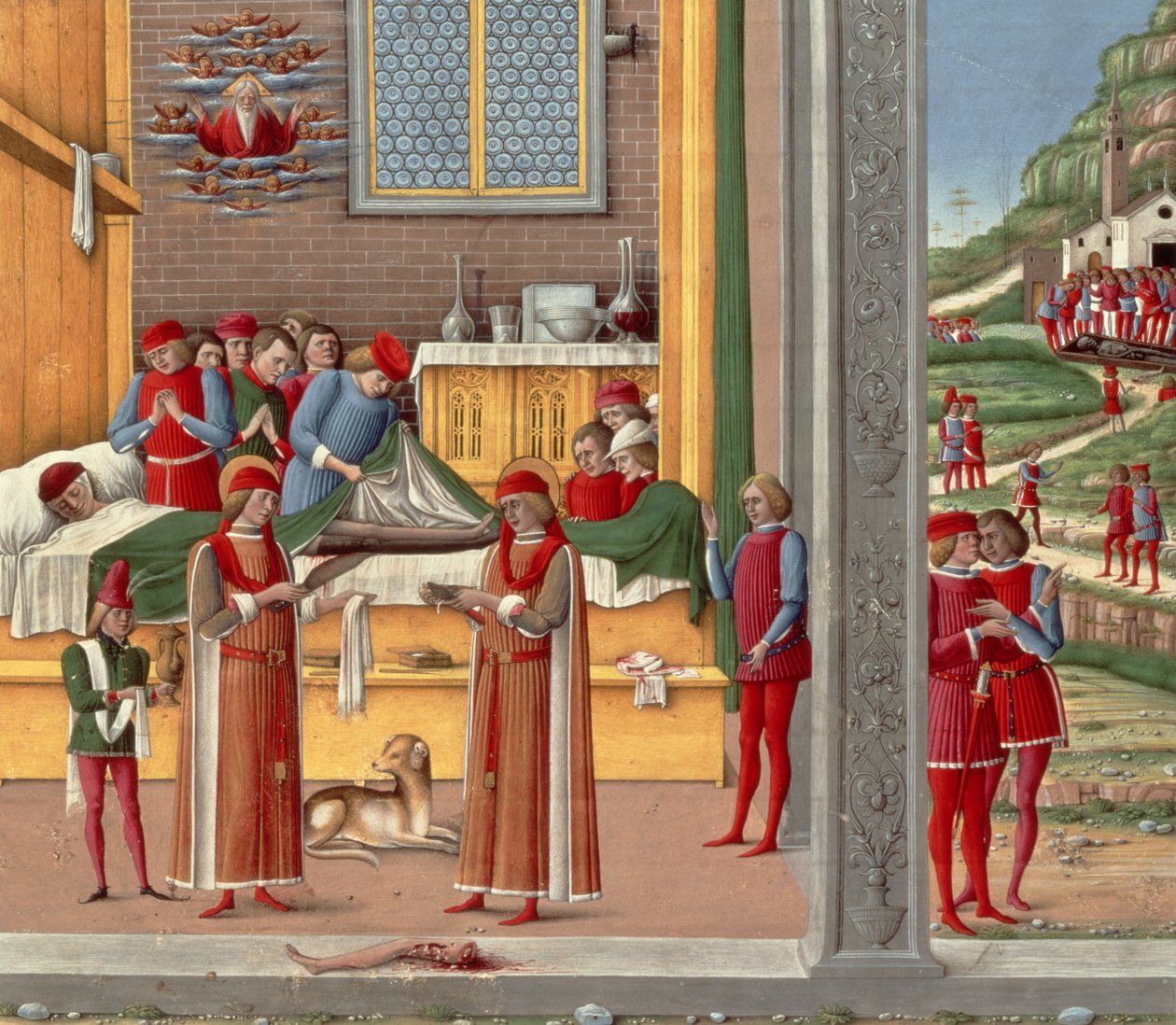Middelaldersk amputasjonsscene (tempera på panel) av Italian School