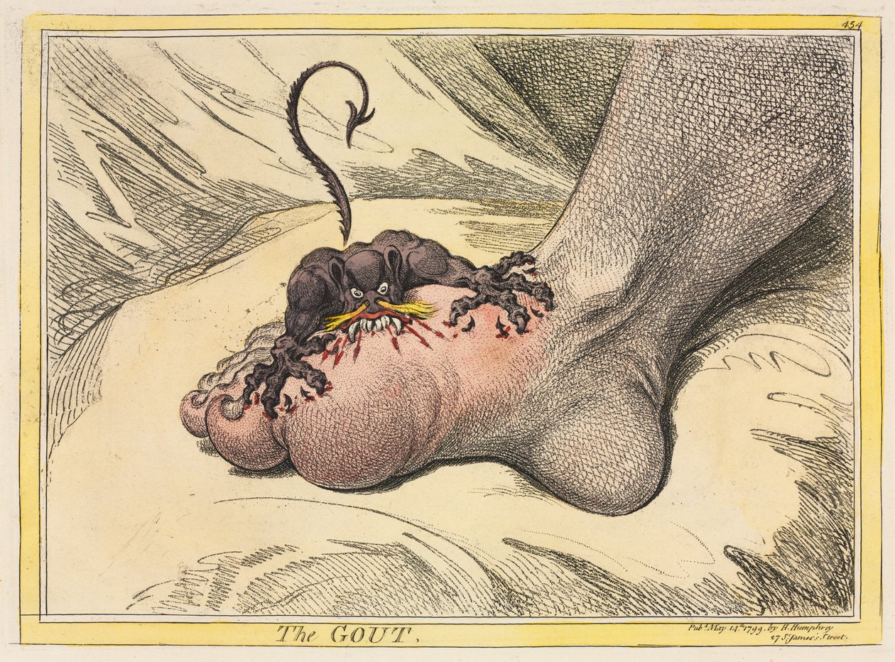 Gikten, 1799. av James Gillray