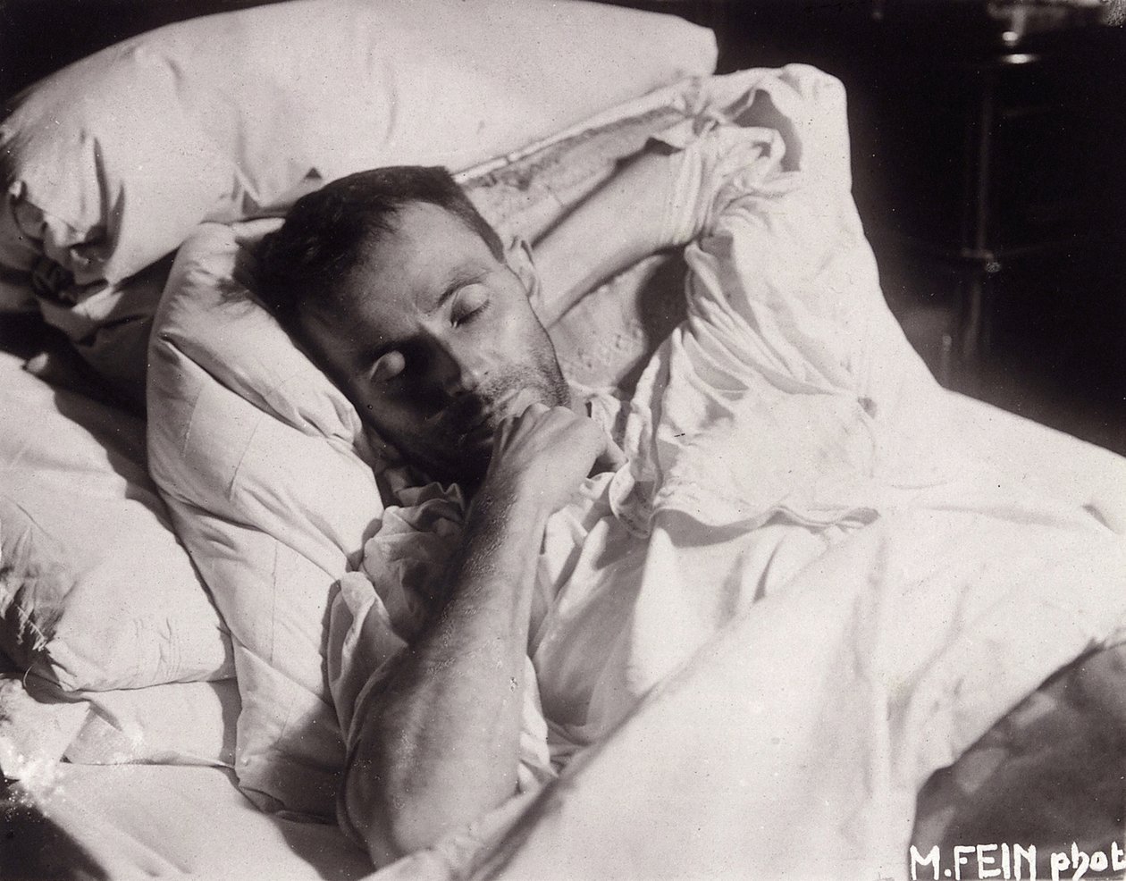Egon Schiele på sitt dødsleie, 1918. av Martha Fein
