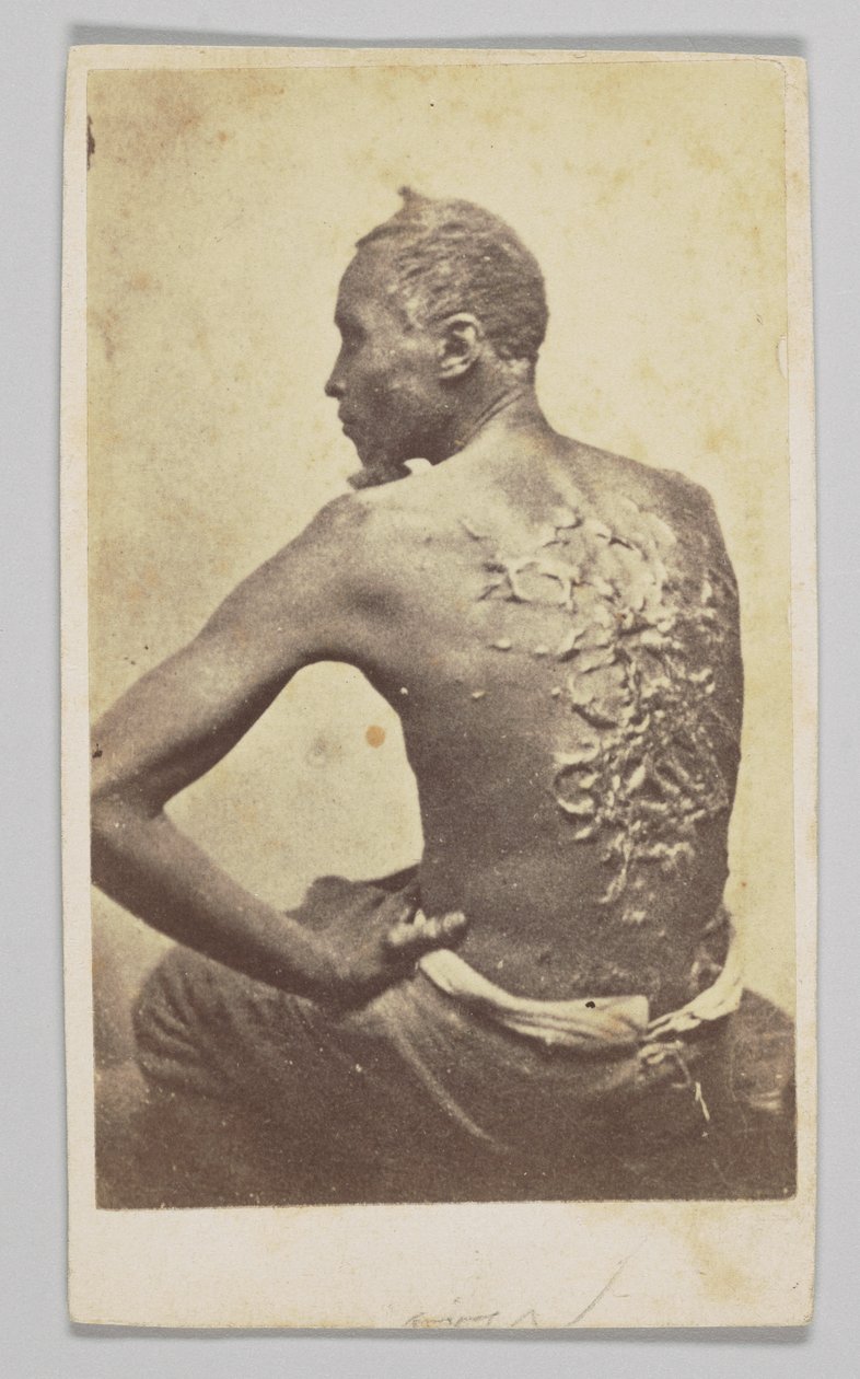 Gordon under medisinsk inspeksjon, 1863. av McPherson and Oliver