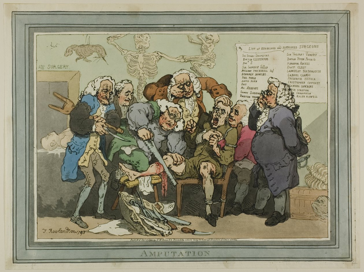 Amputasjon av Thomas Rowlandson