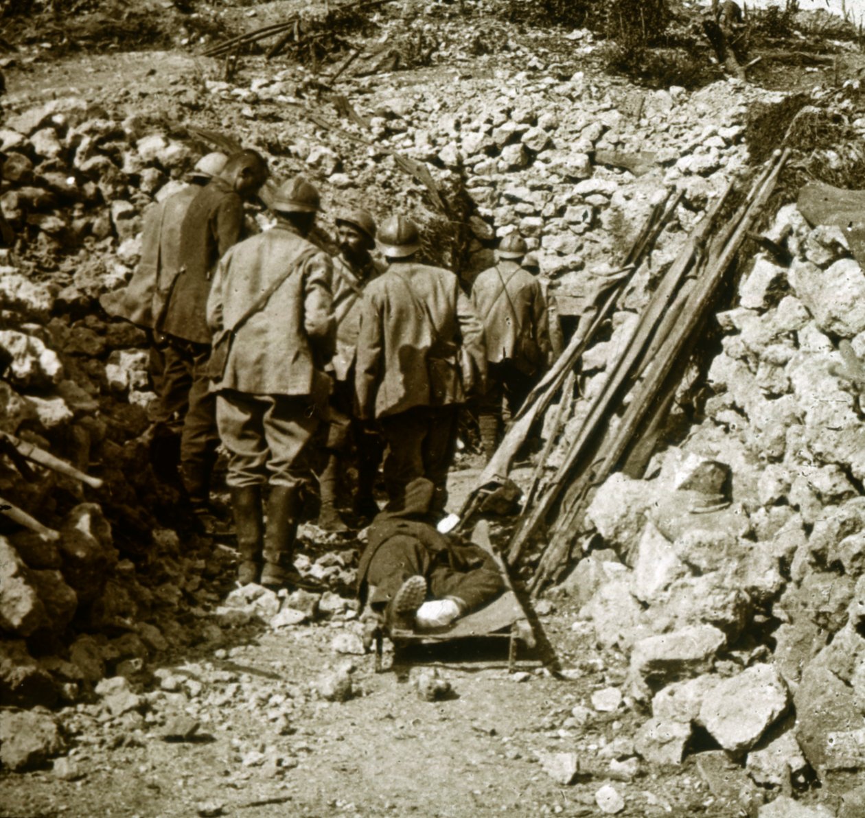Tyske sårede, c1914-c1918 av Unbekannt