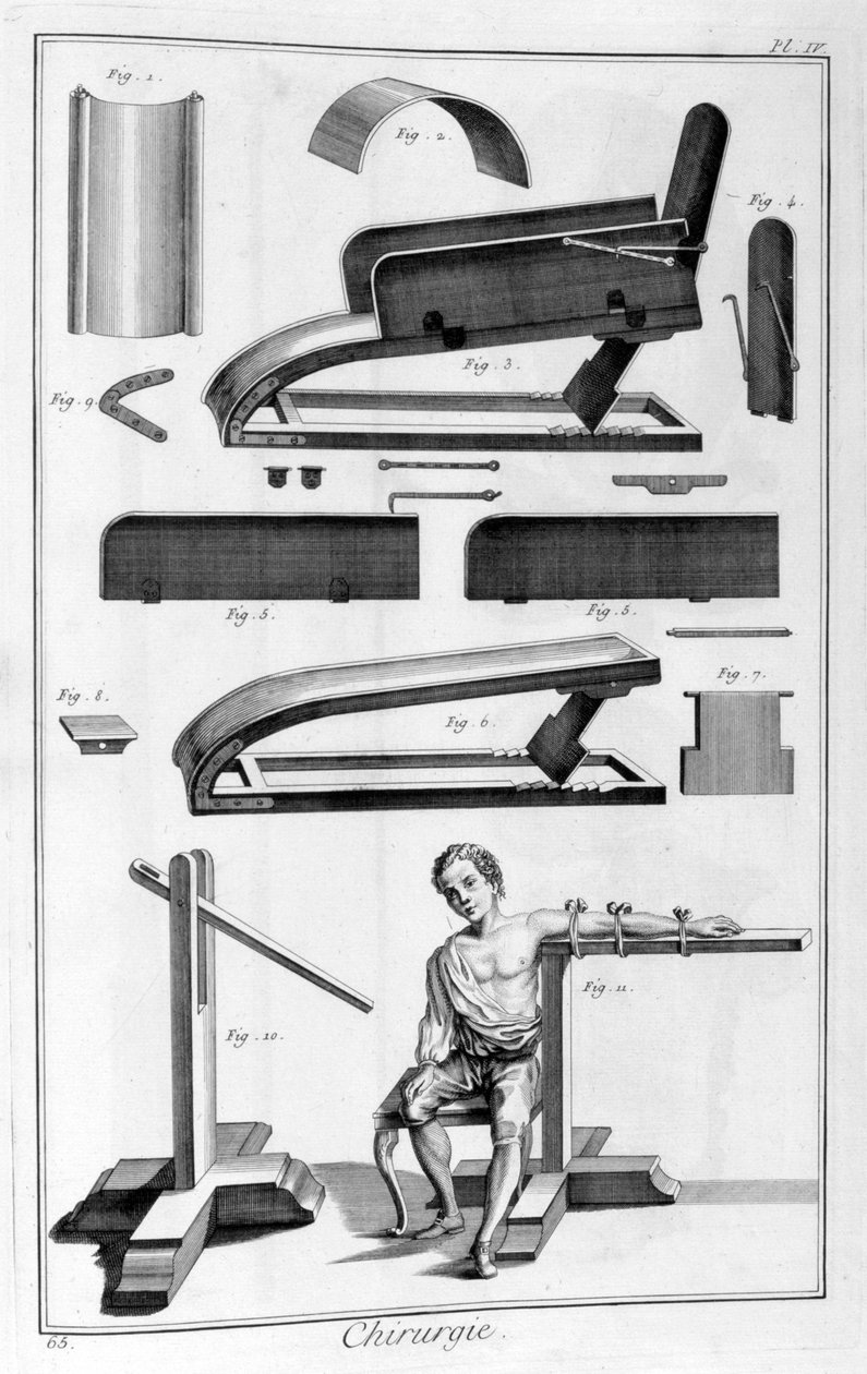 Kirurgi, 1751-1777 av Unbekannt