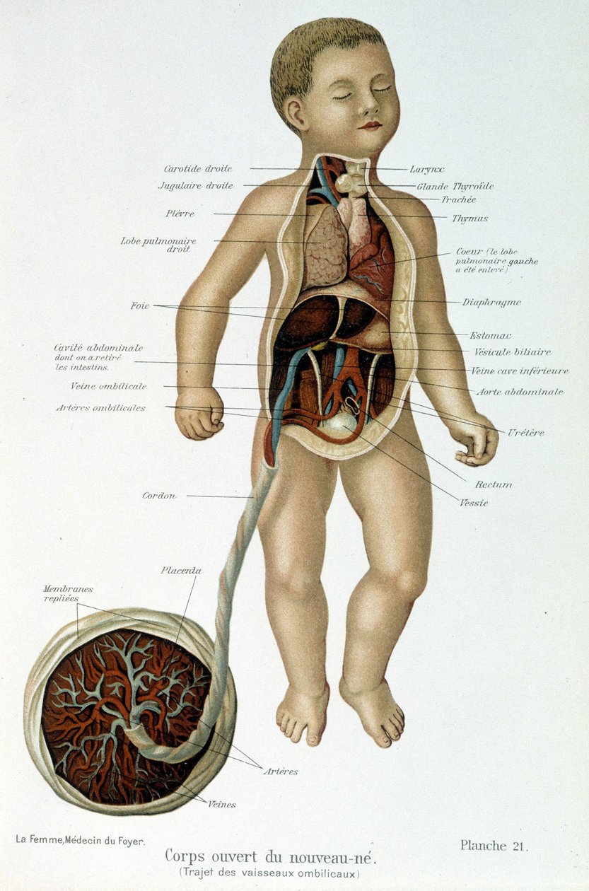 Medisin: nyfødt (flådd i bysten). av Unknown artist
