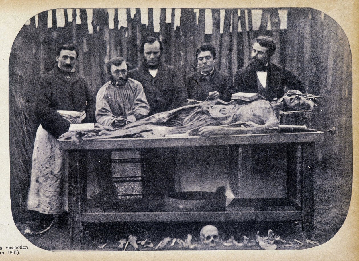 Disseksjon, v.1865. av Unknown photographer