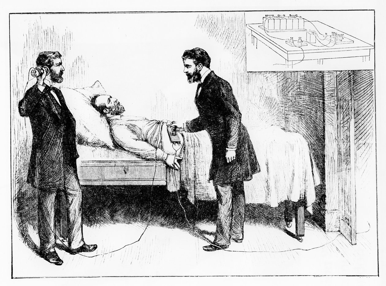 President Garfield (1831-81) ligger med en uoppdaget kule i seg, 1881 (bw-bilde) av W. Shinkle