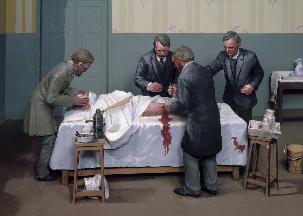 Kirurgiske antiseptiske midler En antiseptisk operasjon av Ferdinand Georg Waldmuller