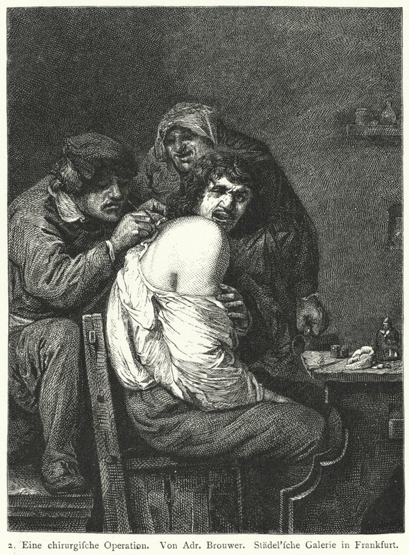 Ryggoperasjonen av Adriaen (after) Brouwer
