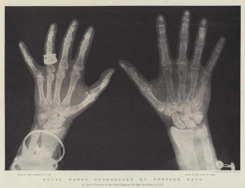 Royal Hands gjengitt av Rontgen Rays (gravering) av English School