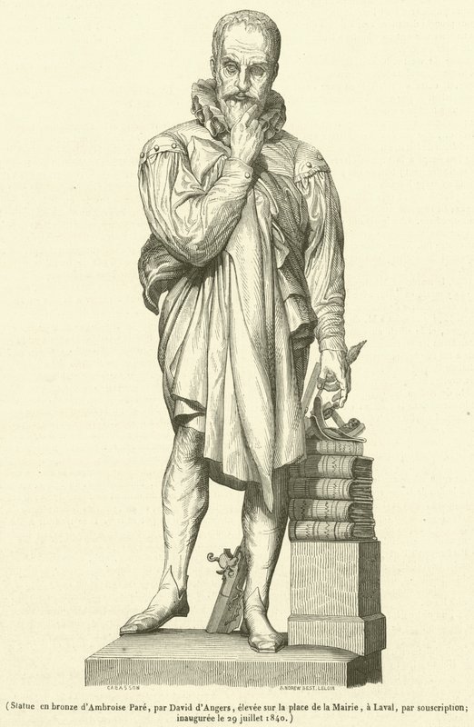 Bronsestatue av Ambroise Pare (gravering) av French School