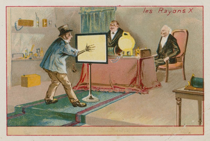 Røntgenstråler av French School
