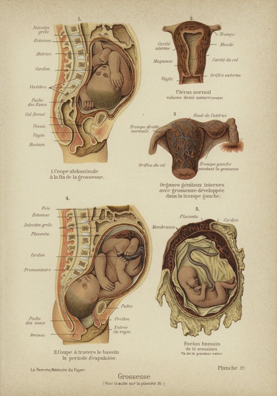 Graviditet (farge litho) av German School
