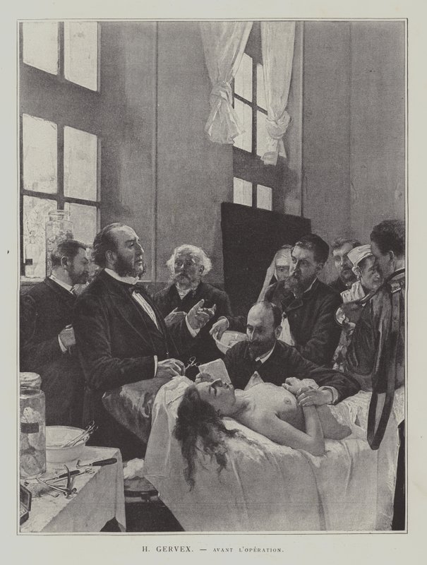 Avant lOperation (før operasjonen) av Henri Gervex